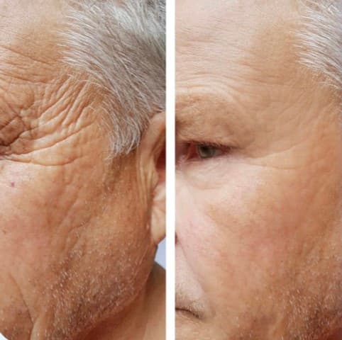 Skin Care